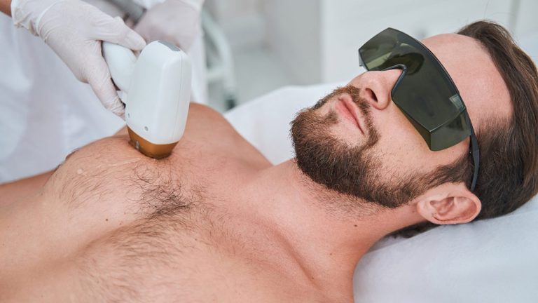 postlaserhairremoval