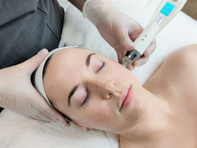 mesotheraphy teratment