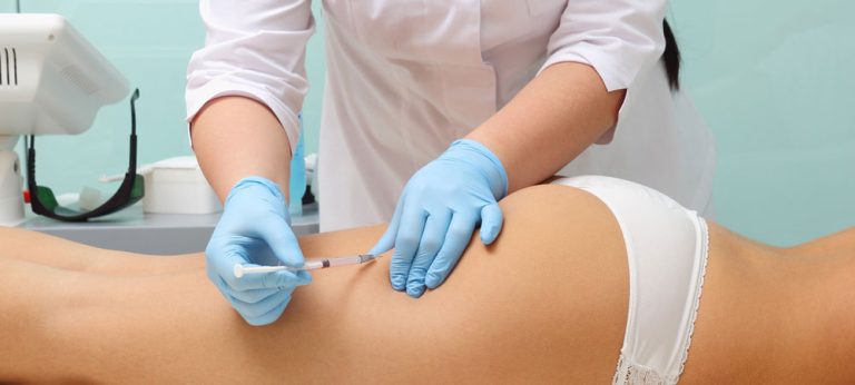 Mesotherapy for Cellulite