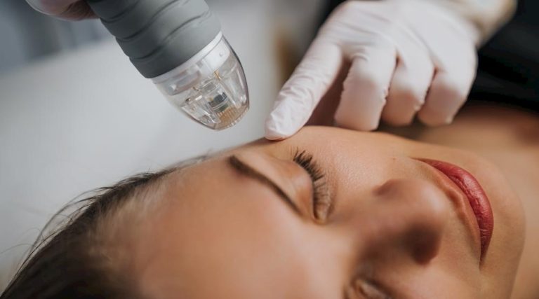 microneeding