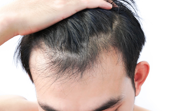 prp treatment