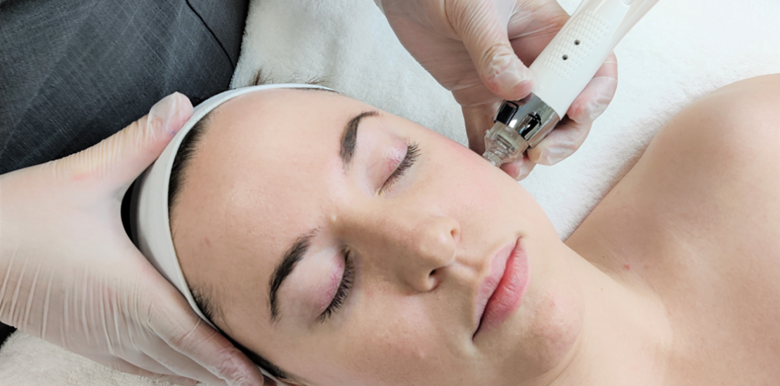 mesotheraphy teratment