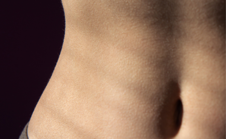 fat-dissolving-treatment-aqualyx-img3