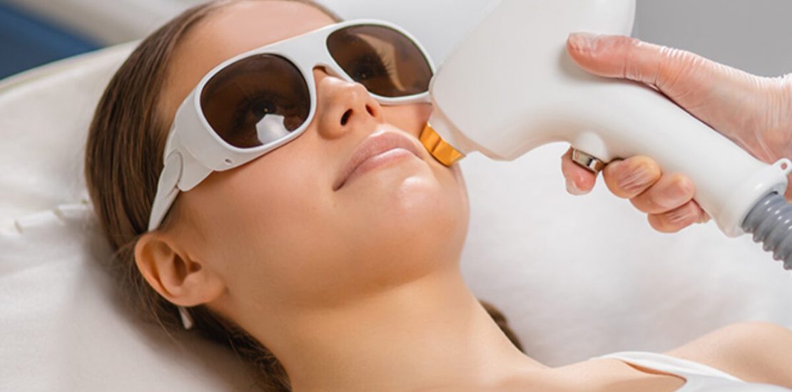 laser hair removal
