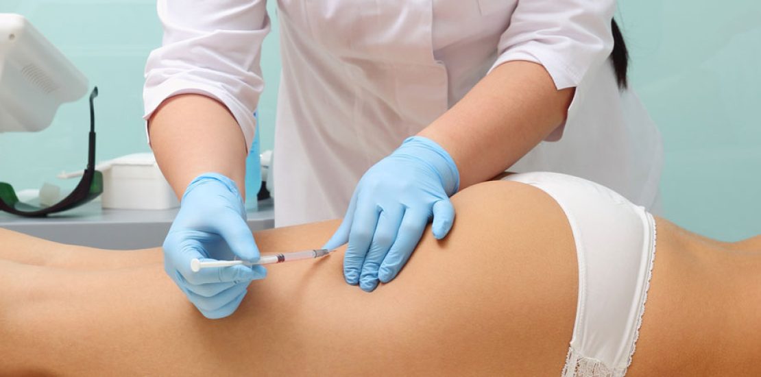 Mesotherapy for Cellulite